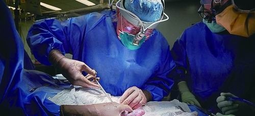 世界首例异种移植尚需谨慎乐观|中国科学报|器官移植|异种_新浪新闻