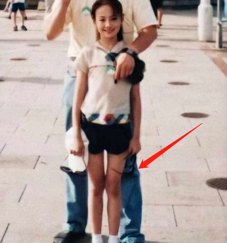 有种"超常发育"叫郑爽,见到童年修复照下的细腿,柠檬酸了