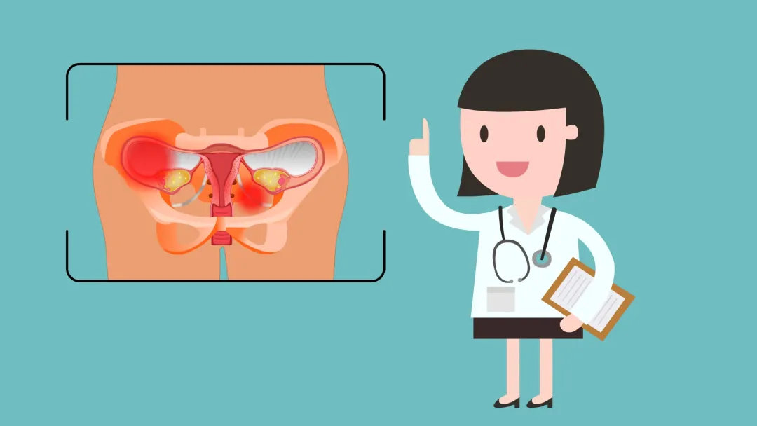 治 疗盆腔脓肿建议住院治疗,警惕脓肿破裂的症状.