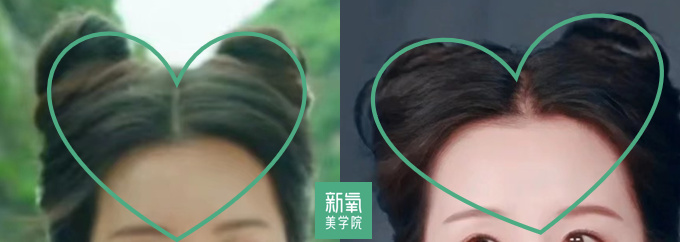 《狐妖小红娘》官宣剧照，古装剧终于不是丧葬风了！休闲区蓝鸢梦想 - Www.slyday.coM