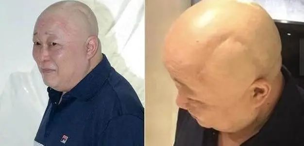 "包青天"金超群罕现身,拄拐杖身材发福,脑瘤手术后恢复的不错|金超群