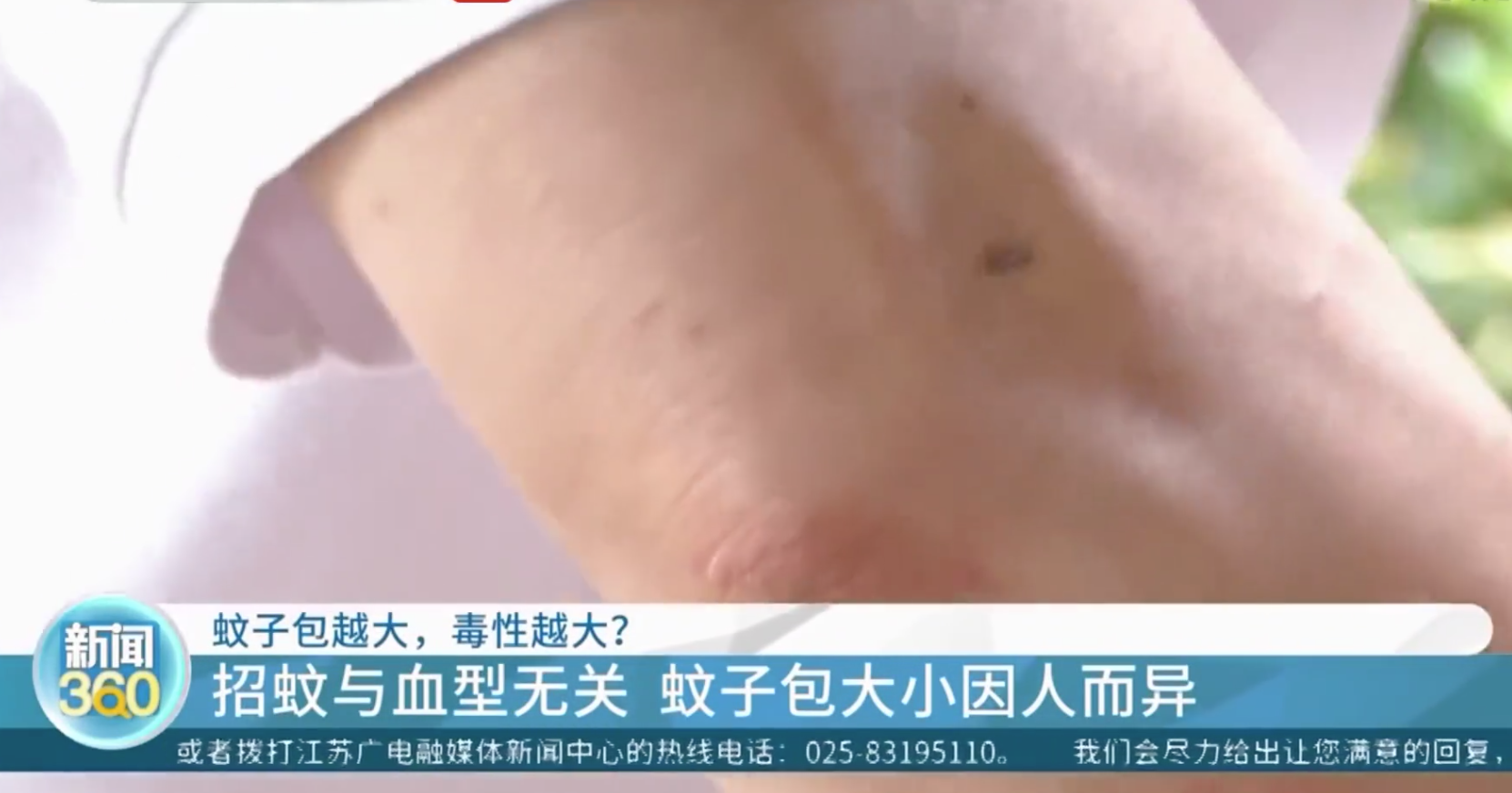 热搜！蚊子包越大毒性越大、蚊子爱叮O型血？专家：没有科学依据！蚊子其实爱叮这类人……休闲区蓝鸢梦想 - Www.slyday.coM