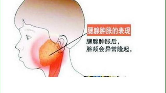 济南小儿推拿杨晓：春季流行性腮腺炎高发期，如何做好预防和护理|腮腺炎|流行性|腮腺_新浪新闻