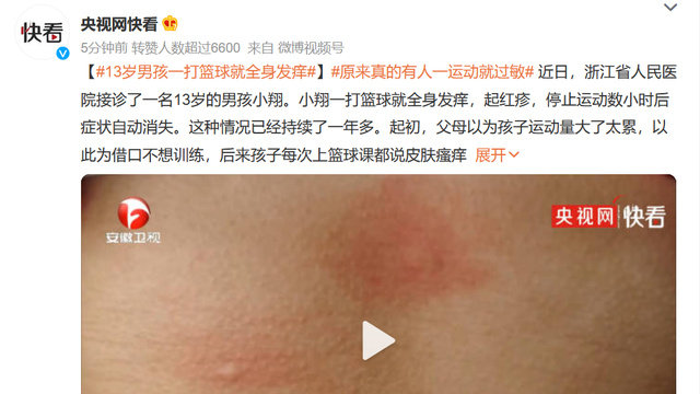 13岁男孩一打篮球就全身发痒|浙江省|荨麻疹|胆碱|过敏|丘疹性_新浪新闻