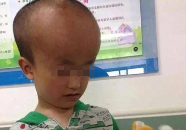 大头娃娃卷土重来揭秘特医奶粉和母婴店套路还娃健康环境