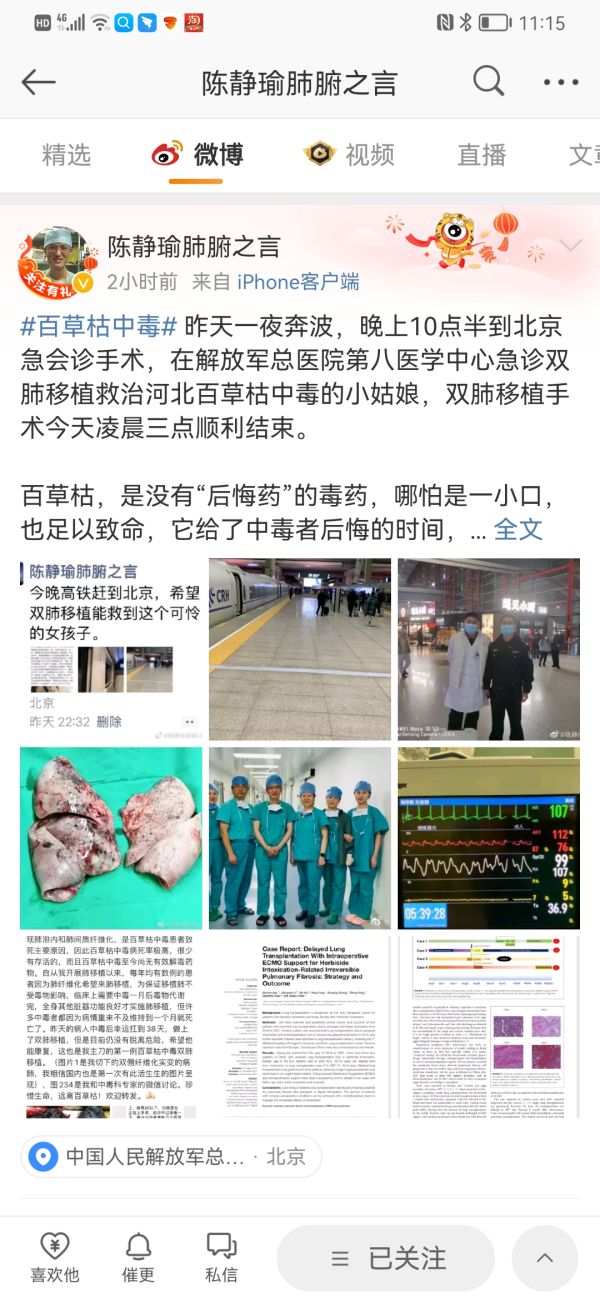 河北被姐夫投毒百草枯女孩完成肺移植手术，主治医生是“中国肺移植第一人”陈静瑜休闲区蓝鸢梦想 - Www.slyday.coM