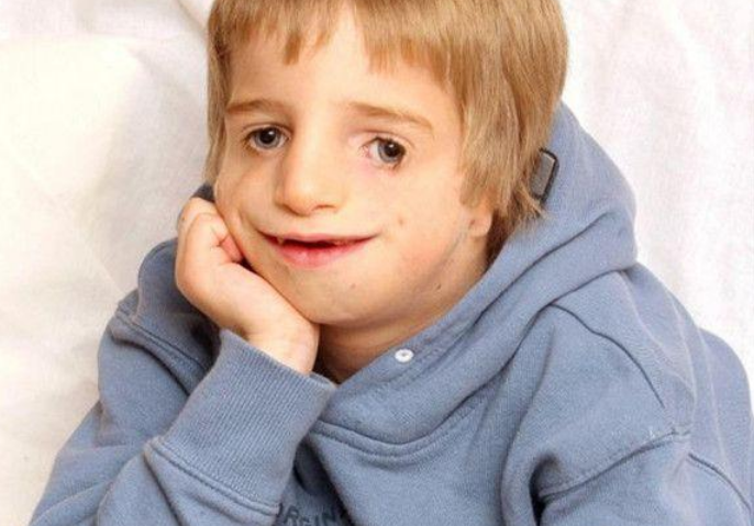 他先天脸部畸形却娶了漂亮媳妇孩子出生后两人没了笑容