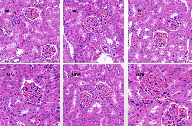 肾脏病理切片白色细箭头所指区域为肾小囊红色粗箭头所指区域为基底膜
