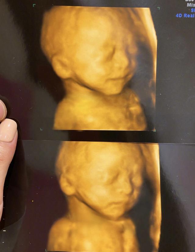 宁桓宇首晒儿子正脸眉清目秀像小女孩儿直呼不敢再说喜欢女儿