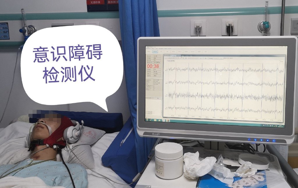 昏迷促醒系列:60岁弥漫性颅脑损伤昏迷病人下地行走了