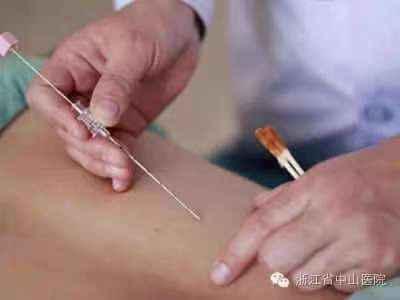 科学减肥｜中医穴位埋线，180斤小伙半年瘦30斤休闲区蓝鸢梦想 - Www.slyday.coM
