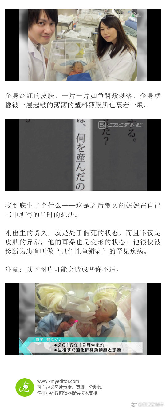 全身皮肤剥落 耳朵变形 怕见阳光 全身皮肤剥落 耳朵变形 怕见阳光