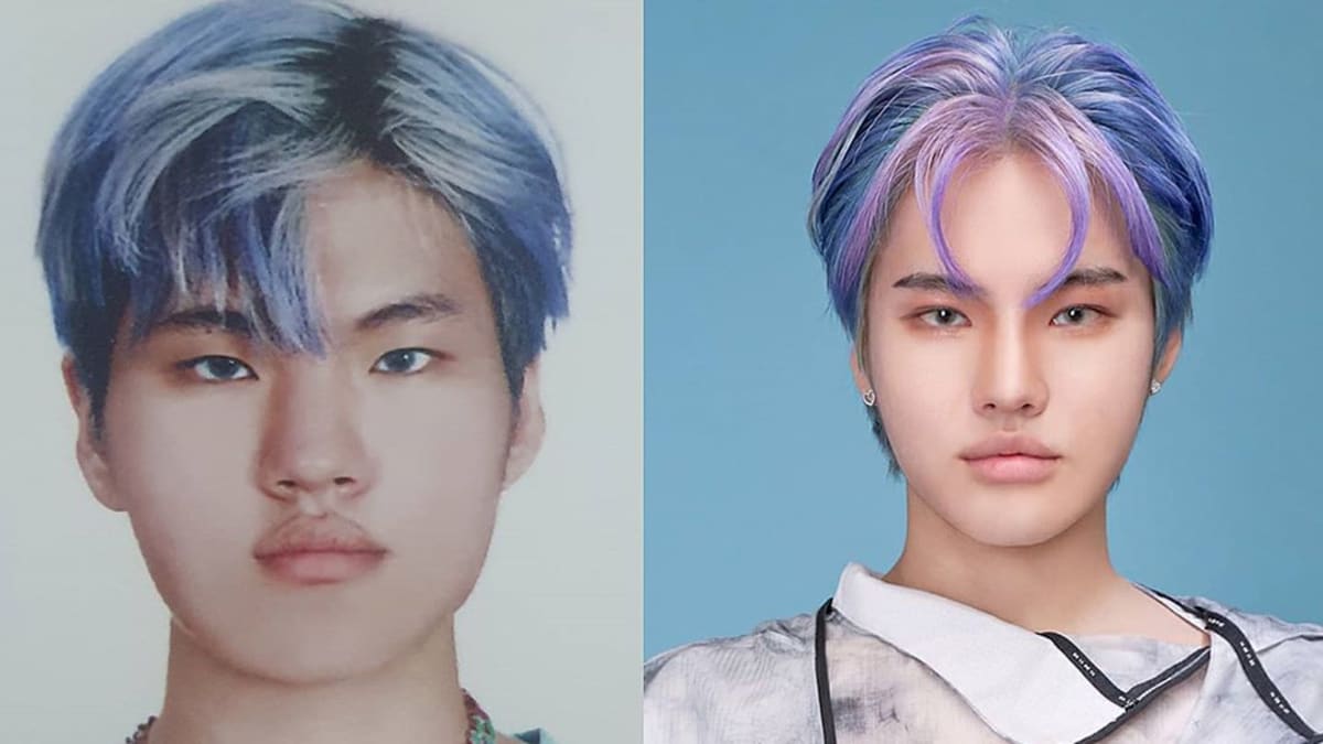 韩国rapper公开整容过程 惊人前后对比引热议