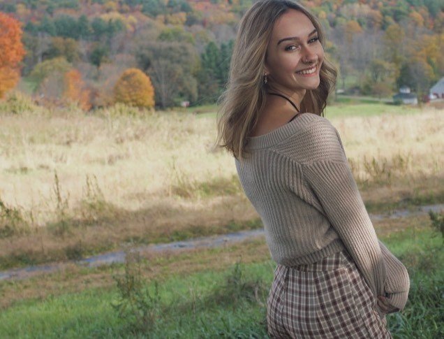 美国18岁漂亮女孩手臂似绿巨人,罕见病导致却遭攻击,“该去截肢”休闲区蓝鸢梦想 - Www.slyday.coM 美国18岁漂亮女孩手臂似绿巨人,罕见病导致却遭攻击,“该去截肢”休闲区蓝鸢梦想 - Www.slyday.coM