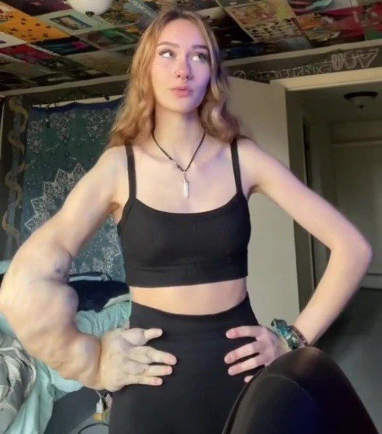 美国18岁漂亮女孩手臂似绿巨人,罕见病导致却遭攻击,“该去截肢”休闲区蓝鸢梦想 - Www.slyday.coM 美国18岁漂亮女孩手臂似绿巨人,罕见病导致却遭攻击,“该去截肢”休闲区蓝鸢梦想 - Www.slyday.coM