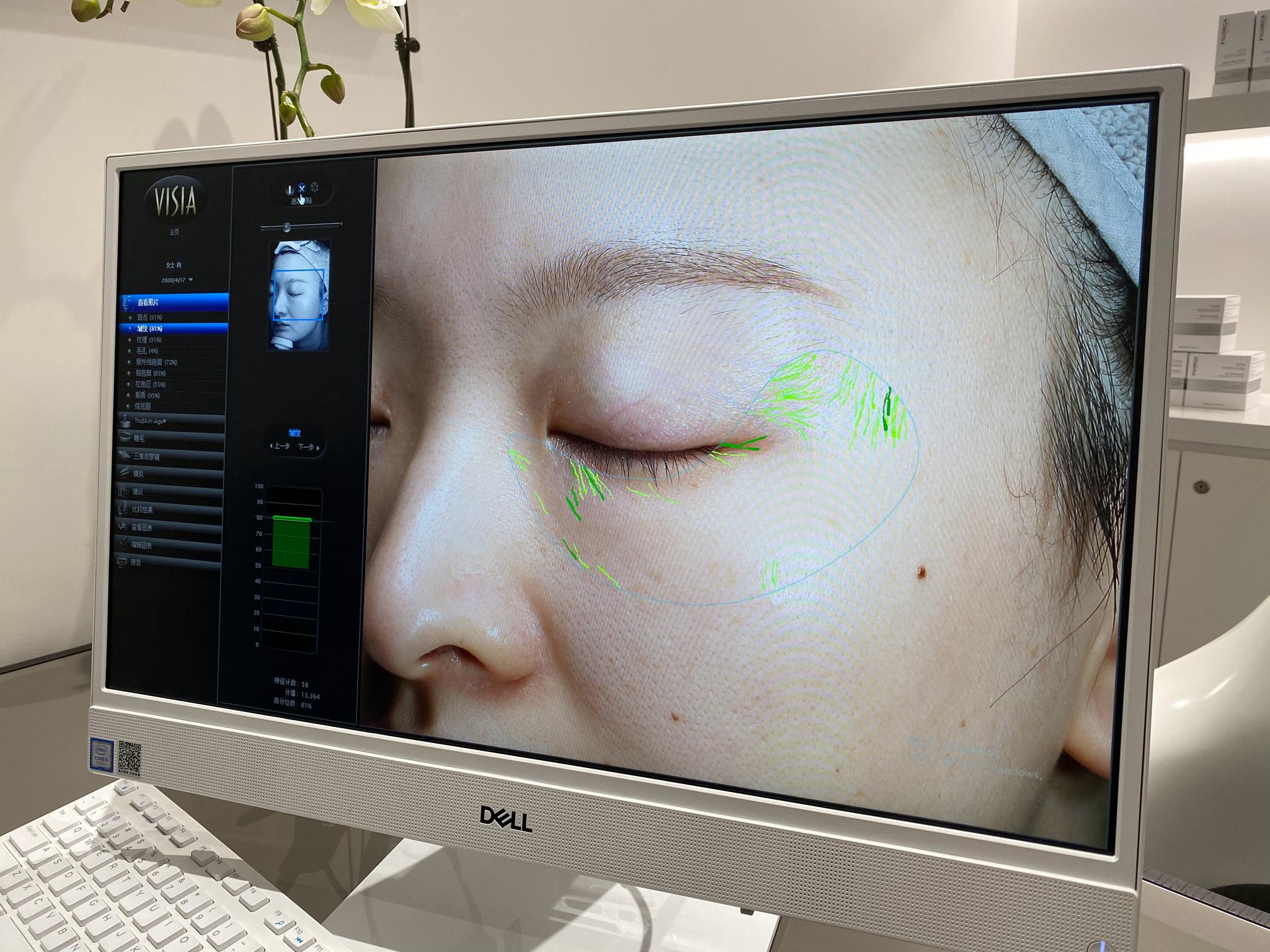 昨天去菲洛嘉用visia做了皮肤检测……|洛嘉_新浪新闻