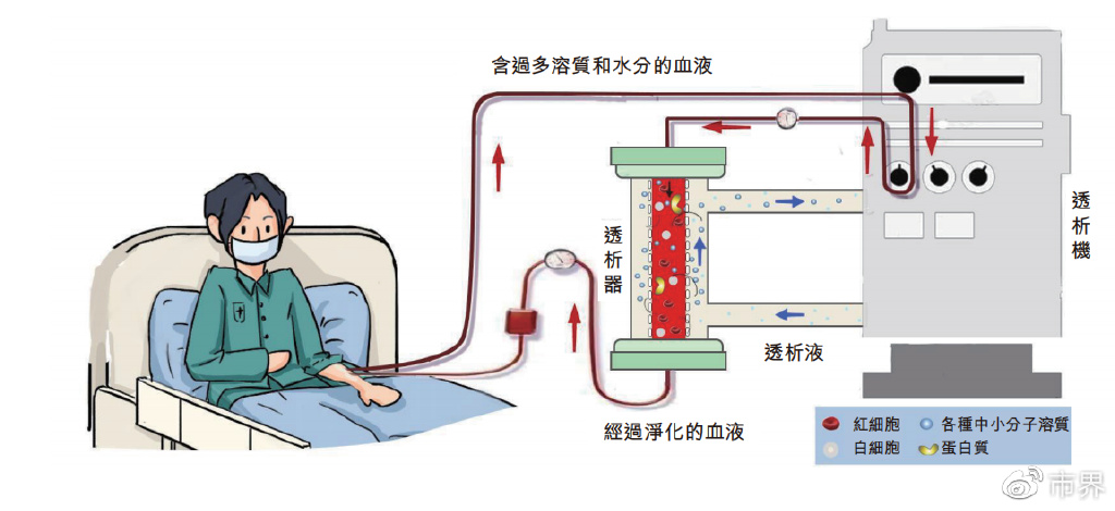 威高血液成立于2004年底,所处赛道为血液净化,生产血液透析及腹膜透析