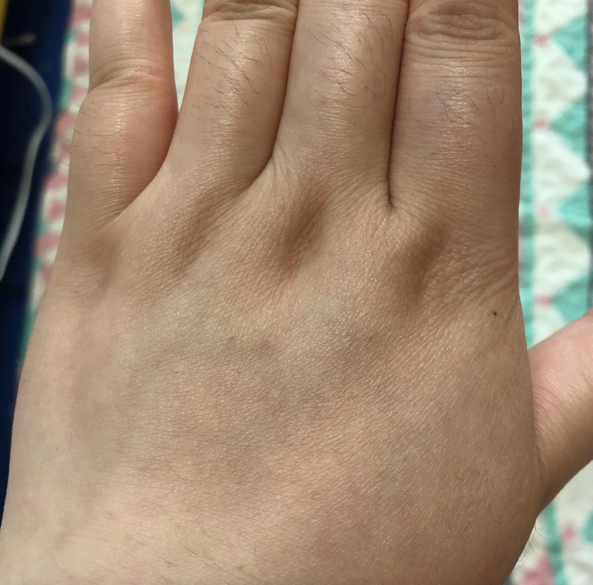 哈哈哈哈哈还有这种说法嘛请大胆晒出你们的手背窝窝图一是我的手