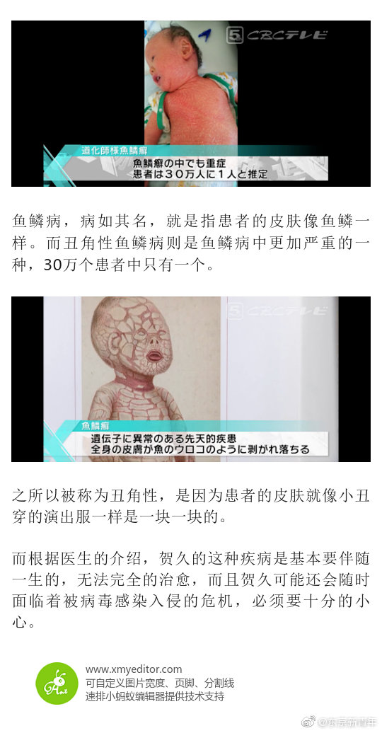 全身皮肤剥落 耳朵变形 怕见阳光 全身皮肤剥落 耳朵变形 怕见阳光