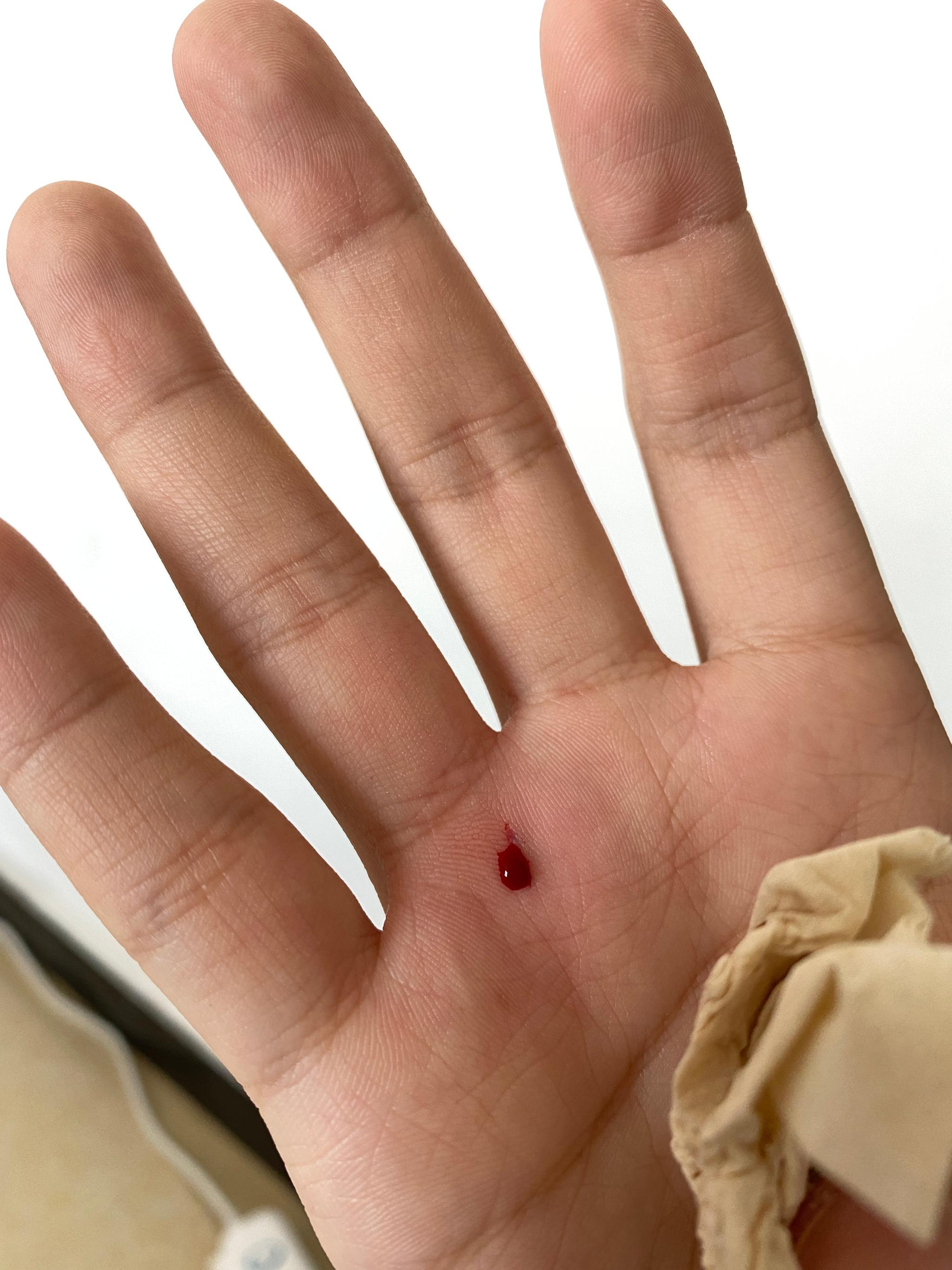 拆个快递废了右手玻璃直接扎进了手掌正好禁欲了