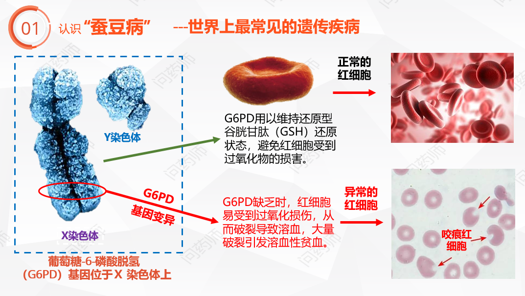 「蚕豆病」宝宝的五条用药原则