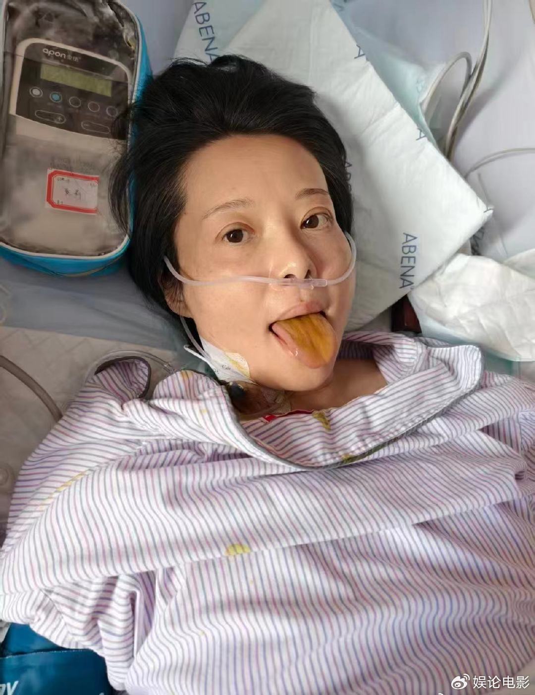 54岁退圈女星患病住院,坚持做公益,要活到耄耋之年满头白发|袁立|梁太平|娱乐圈|明星|账号_新浪娱乐_新浪新闻