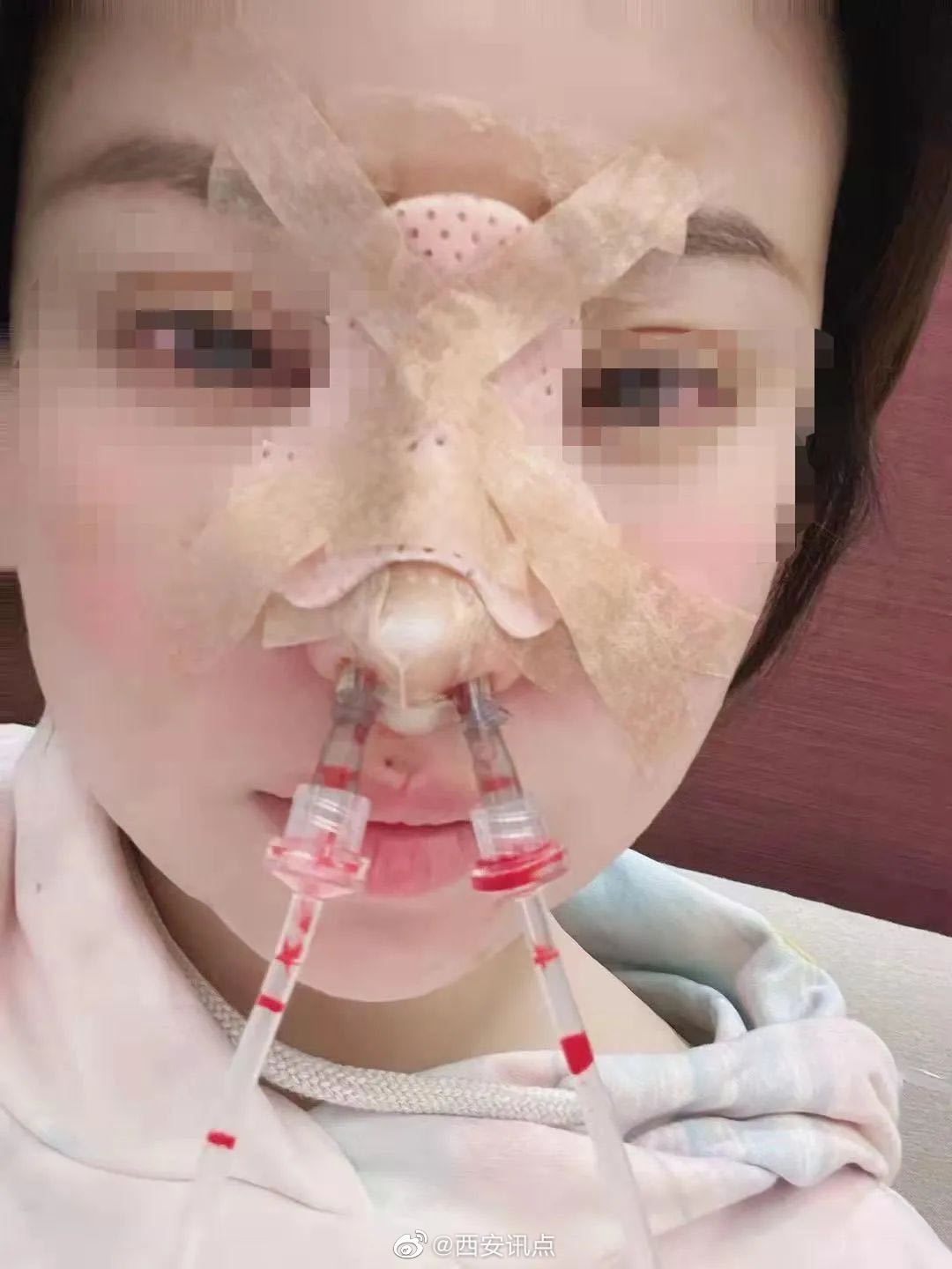 做医美手术失败 女子耳朵永久性留疤西安碑林吴学勤医疗美容诊所被质休闲区蓝鸢梦想 - Www.slyday.coM