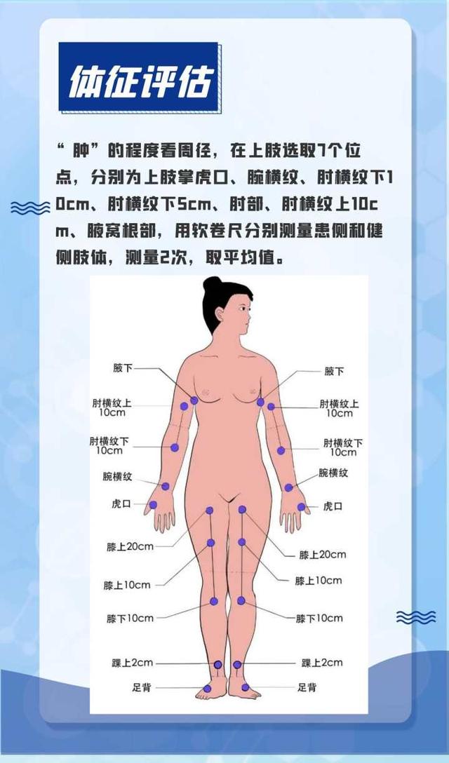 乳腺癌术后，她上肢水肿、皮肤变粗……医生提醒，这些患者，到了夏天要格外注意休闲区蓝鸢梦想 - Www.slyday.coM