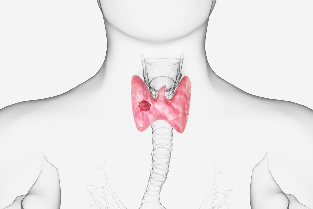 体检时发现的甲状腺结节，到底是个什么问题休闲区蓝鸢梦想 - Www.slyday.coM