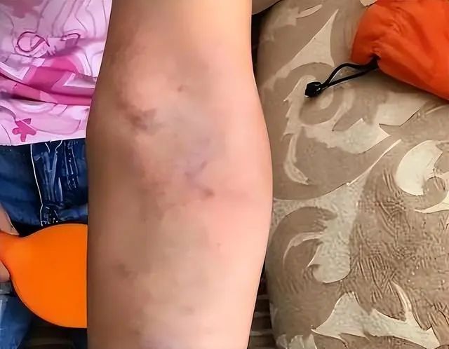 把这3种肝毒排干净，整个人都变了，脾气好、睡眠好、气色好！休闲区蓝鸢梦想 - Www.slyday.coM