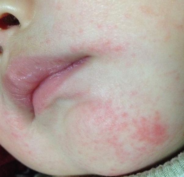 小宝宝总是吐泡泡是因为妈妈孕期吃螃蟹真正原因是这三个