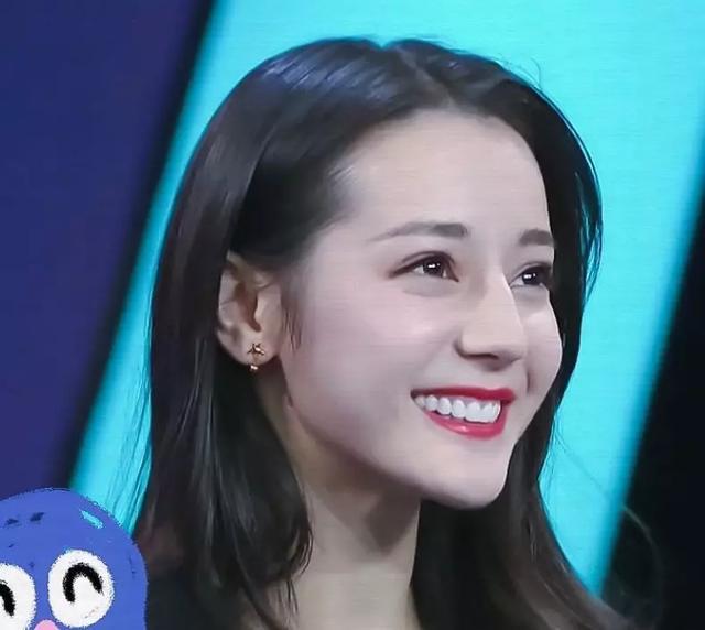 这些明星都毁在一口大白牙?吴昕牙龈发黑热巴显老,陈瑶包不住嘴