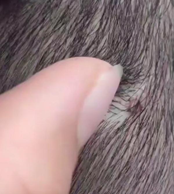 危险!危险!阜阳有人中招!严重可致命!|蜱虫|蜱|阜阳_新浪新闻