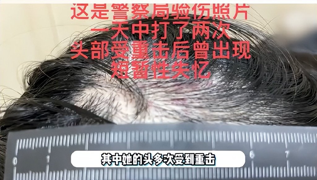 演员王东家暴妻子视频曝光,多次失联,婚内出轨,他还委屈得不行休闲区蓝鸢梦想 - Www.slyday.coM 演员王东家暴妻子视频曝光,多次失联,婚内出轨,他还委屈得不行休闲区蓝鸢梦想 - Www.slyday.coM