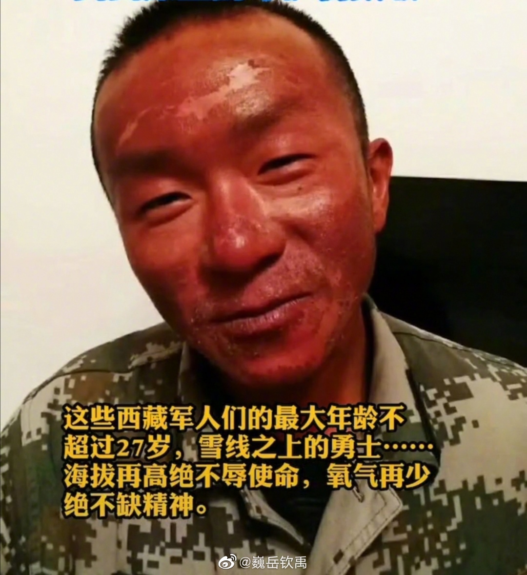 边防战士受伤的脸高清图片