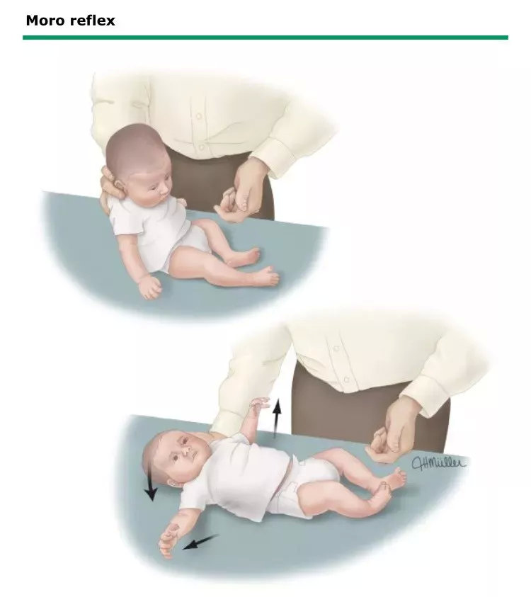 这些与生俱来的生理反射，暗藏宝宝的健康信息__财经头条