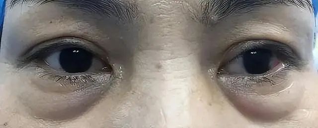 把这3种肝毒排干净，整个人都变了，脾气好、睡眠好、气色好！休闲区蓝鸢梦想 - Www.slyday.coM