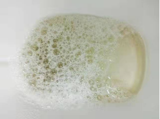 认识蛋白尿做好慢性肾脏病的预防和早期诊断