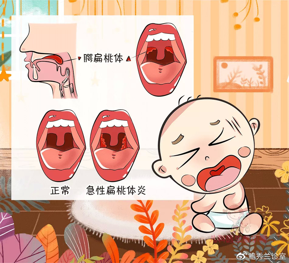 孩子扁桃体为啥老发炎