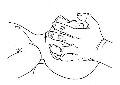 (托颌法-双手)③建立呼吸也就是我们经常说的口对口人工呼吸.