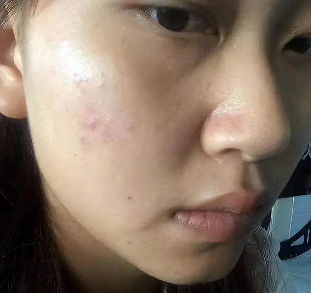 化妆不如健脾，这2个方法让你的脸白皙透亮休闲区蓝鸢梦想 - Www.slyday.coM