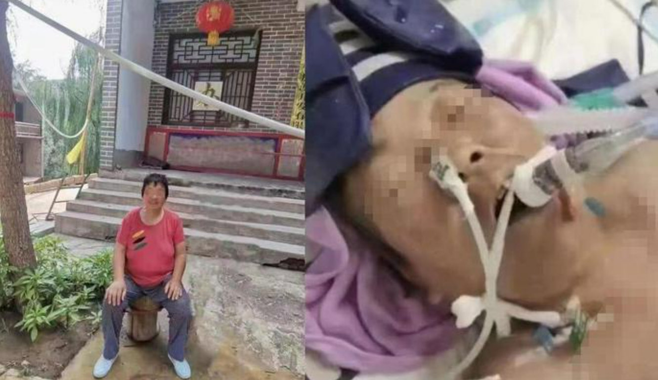 邢台沙河:医生被指收红包做手术,患者术后生命垂危休闲区蓝鸢梦想 - Www.slyday.coM 邢台沙河:医生被指收红包做手术,患者术后生命垂危休闲区蓝鸢梦想 - Www.slyday.coM