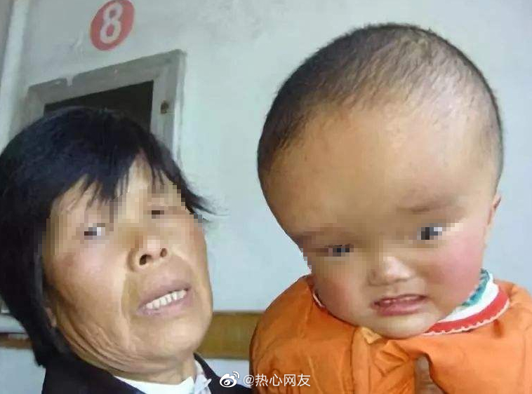 湖南郴州永兴县再现大头娃娃事件 黑心母婴店推销一种叫做"倍氨敏"