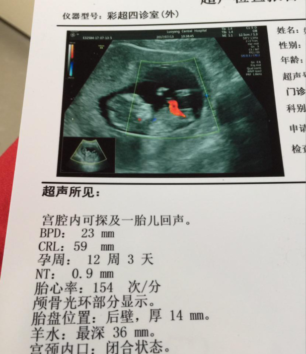 做胎心监护时，医生在孕肚子上面敲铁盘，网友：这盘子是老演员了休闲区蓝鸢梦想 - Www.slyday.coM