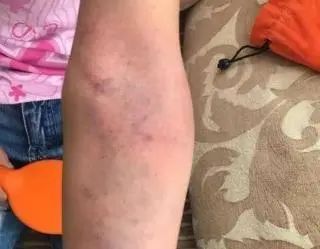 春天把这3种肝毒排干净，整个人都变了，脾气好、睡眠好、气色好！休闲区蓝鸢梦想 - Www.slyday.coM