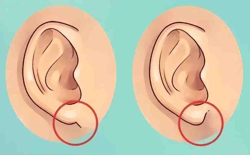 这个部位越大越有福?其实这3点才是福气的象征,你家娃有吗休闲区蓝鸢梦想 - Www.slyday.coM 这个部位越大越有福?其实这3点才是福气的象征,你家娃有吗休闲区蓝鸢梦想 - Www.slyday.coM