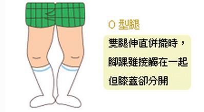 罗圈腿适合什么工作 SEO主要做什么工作