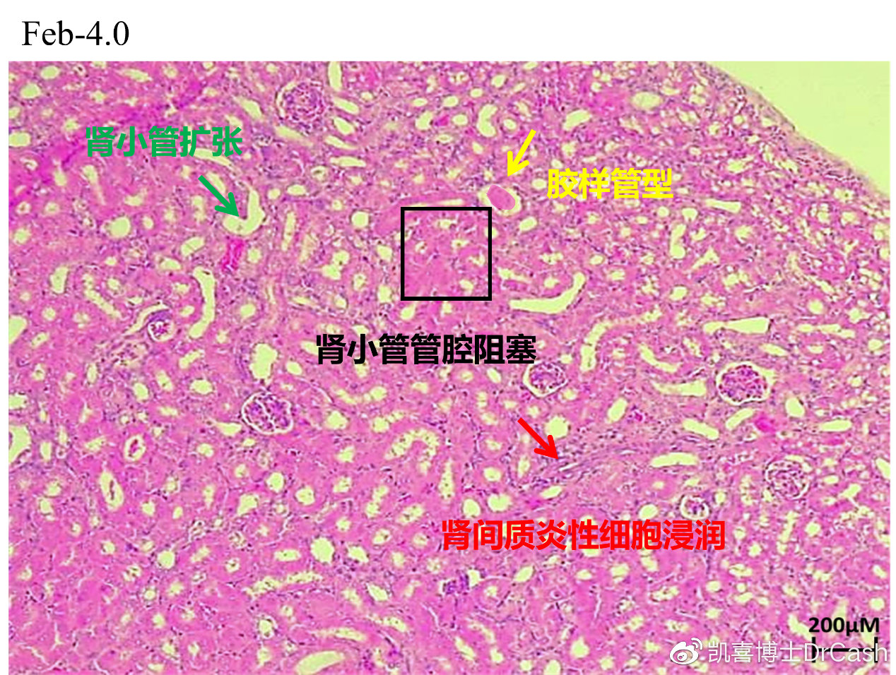 爱因斯坦大脑被谁切片保存 临终遗言说了什么