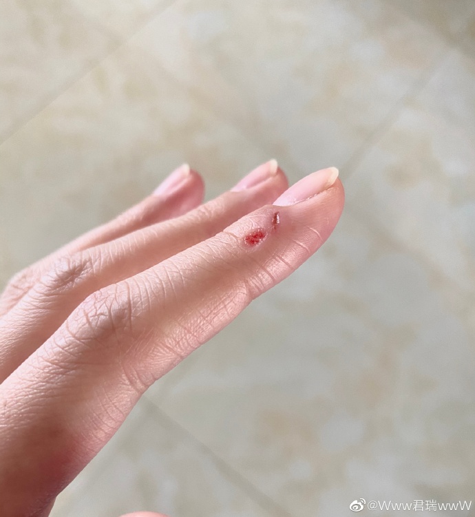 赵继伟太有口福演员女友一次烧7个菜手指连续挨刀引网友心疼