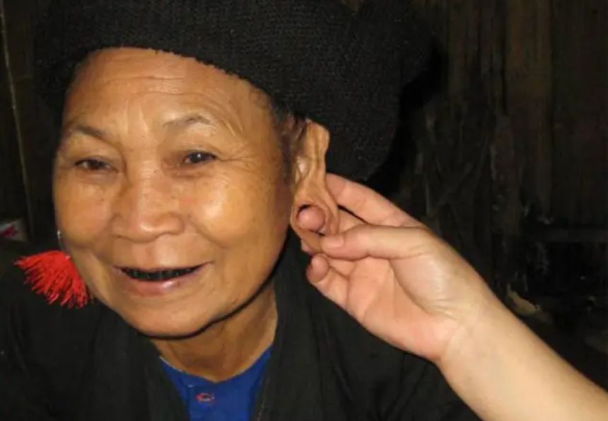 这个部位越大越有福?其实这3点才是福气的象征,你家娃有吗休闲区蓝鸢梦想 - Www.slyday.coM 这个部位越大越有福?其实这3点才是福气的象征,你家娃有吗休闲区蓝鸢梦想 - Www.slyday.coM